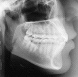 Radiologia Odontológica em Chapecó